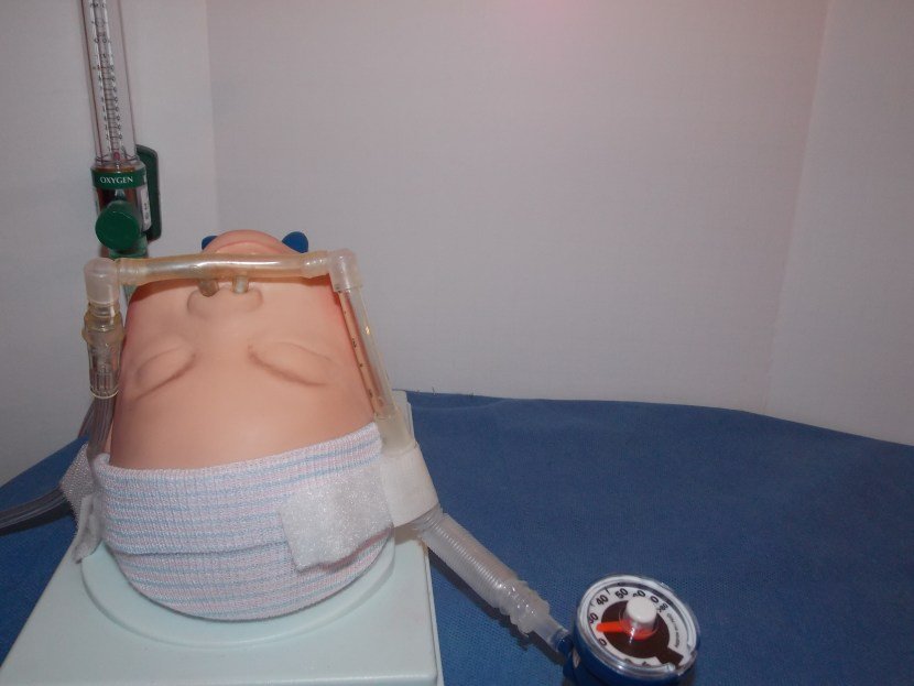 Infant Tracheal Device